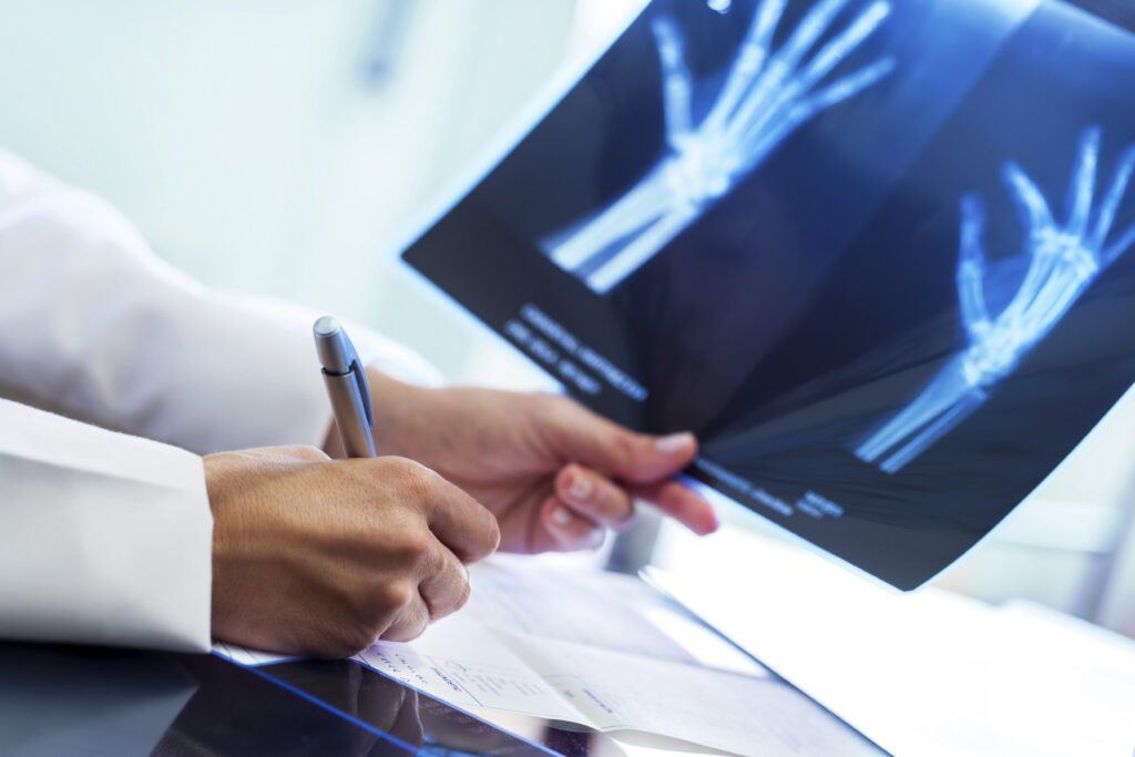 Hand Surgeon | Orthopedic Specialty Institute, Ft. Lauderdale FL